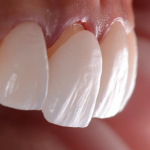 A Look Inside the Digital Smile Design Process