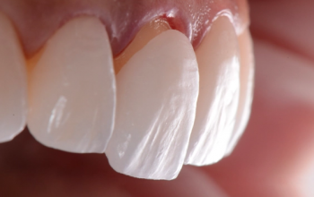 A Look Inside the Digital Smile Design Process