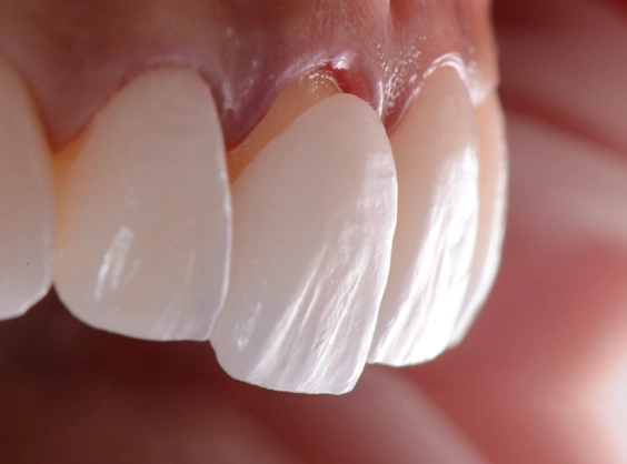 A Look Inside the Digital Smile Design Process